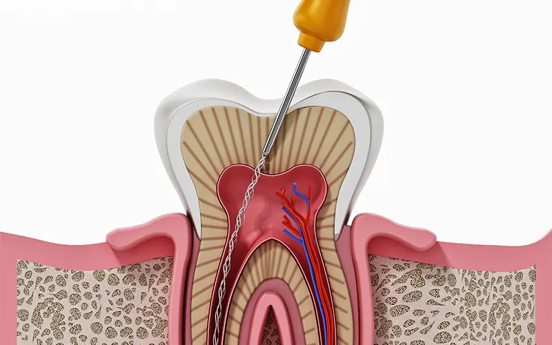 Endodonti