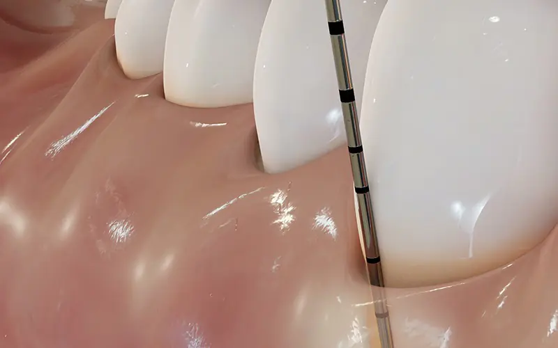 Periodontoloji